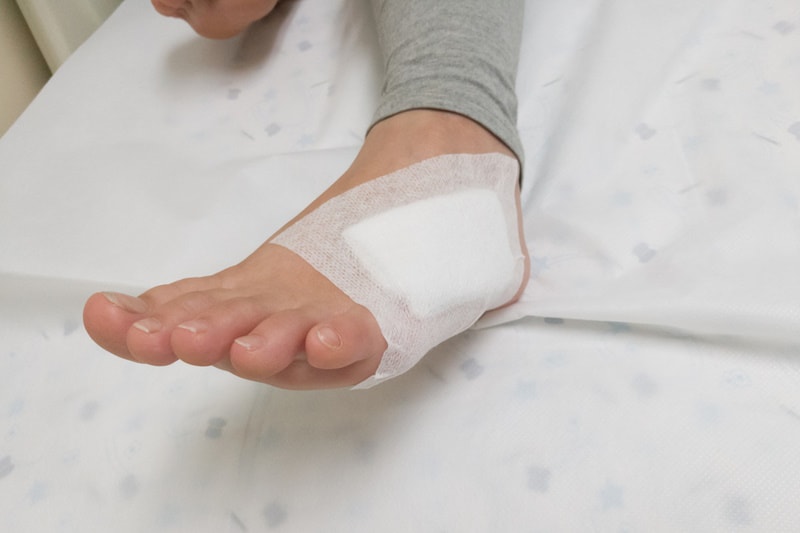 Cat bite wound cleaned and dressed with gauze