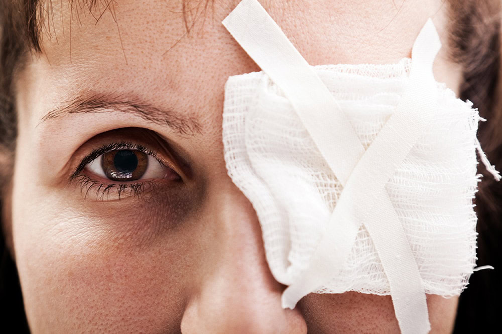 close up woman with patch on right eye injury